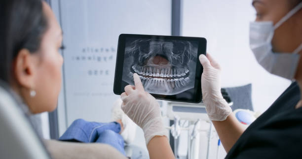 Licensed Tooth Extraction service in Shelby, OH - Smile Center Dentistry